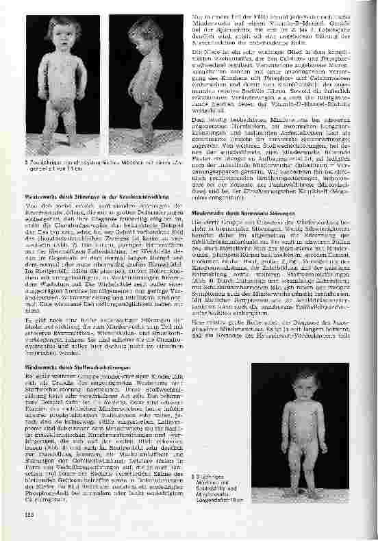 Vorschauseite 2: Über die Ursachen des Minderwuchses