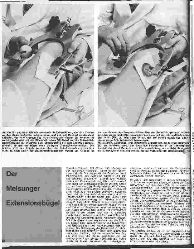 Vorschauseite 1: Der Melsunger Extensionsbügel