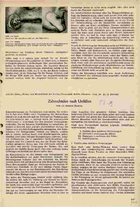 Vorschauseite 4: Über Tumoren im Zahn-, Mundund Kiefergebiet