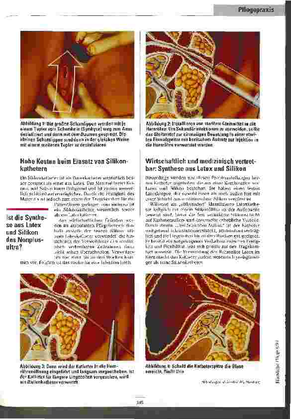 Vorschauseite 2: Katheter Therapiesicher und wirtschaftlich auch bei längeren Liegezeiten?