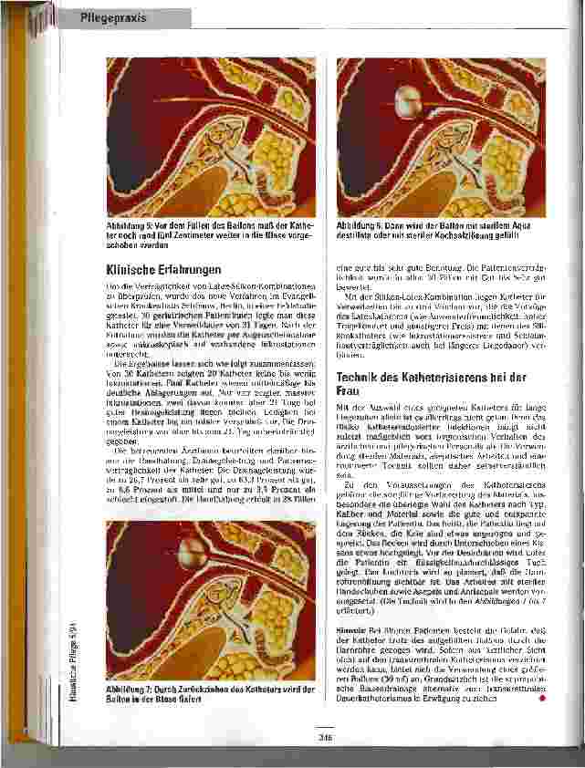 Vorschauseite 3: Katheter Therapiesicher und wirtschaftlich auch bei längeren Liegezeiten?