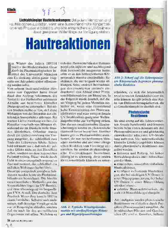 Vorschauseite 1: Hautreaktionen Lichtabhängige Hauterkrankungen