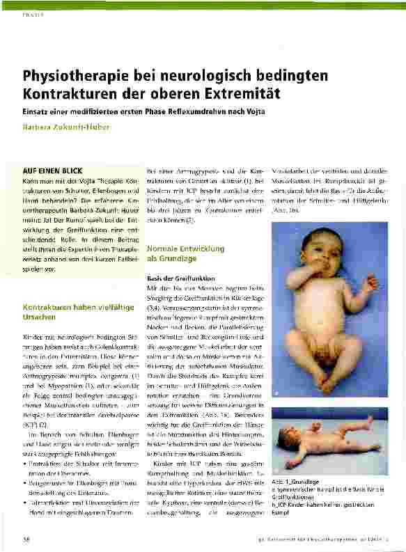 Vorschauseite 1: Physiotherapie bei neurologisch bedingten Kontrakturen der oberen Extremität