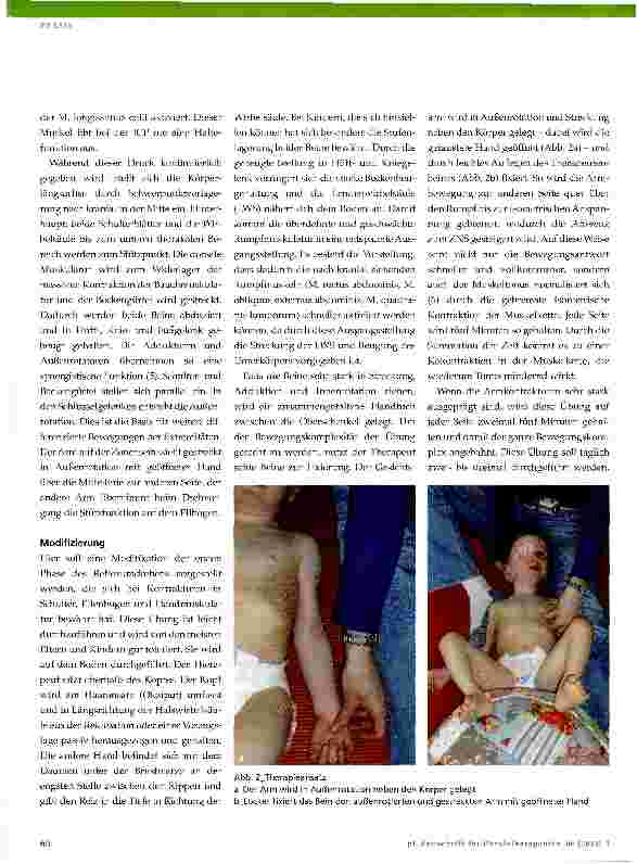 Vorschauseite 3: Physiotherapie bei neurologisch bedingten Kontrakturen der oberen Extremität
