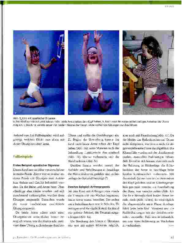 Vorschauseite 4: Physiotherapie bei neurologisch bedingten Kontrakturen der oberen Extremität