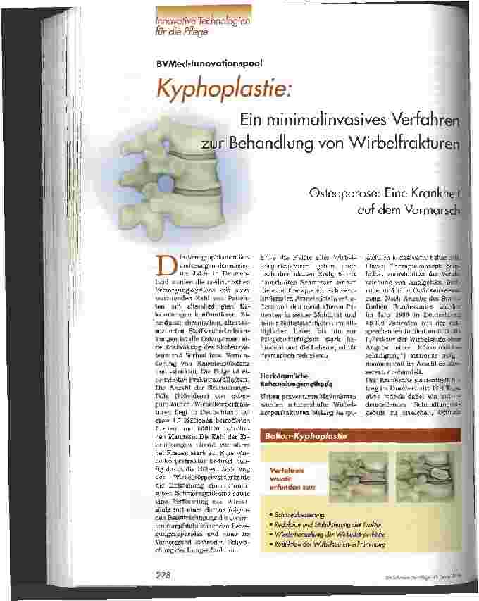 Vorschauseite 1: Kyphoplastie: Ein minimalinvasives Verfahren zur Behandlung von Wirbelfrakturen Osteoporose: Eine Krankheit auf dem Vormarsch