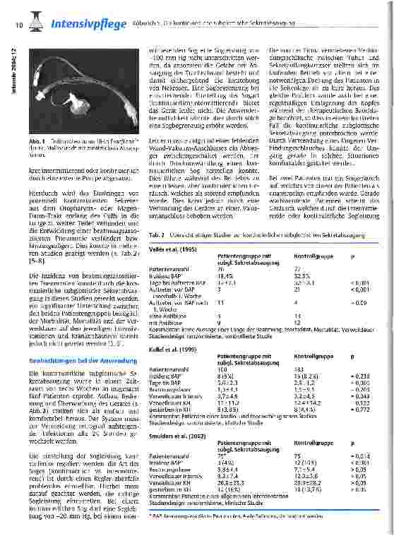 Vorschauseite 2: Die kontinuierliche subglottische Sekretabsaugung als adjuvante Maßnahme zur Prävention beatmungsassoziierter Pneumonien Ein Praxisbericht