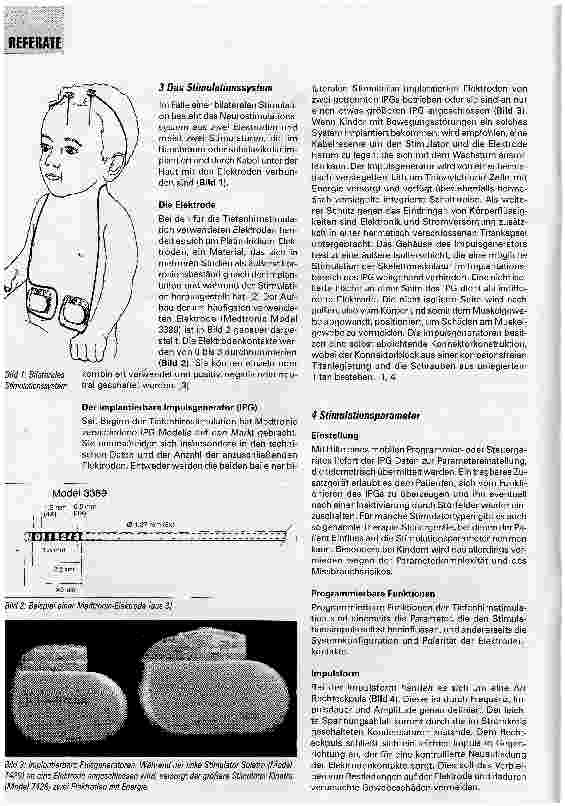Vorschauseite 2: Zur Technik der TiefenhirnstimulationTeil 1: Parameter und Störquellen
