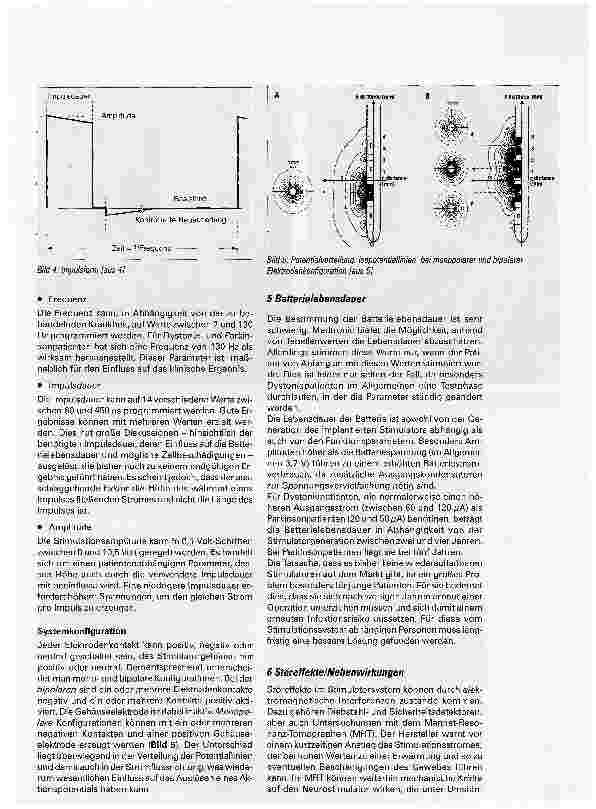 Vorschauseite 3: Zur Technik der TiefenhirnstimulationTeil 1: Parameter und Störquellen