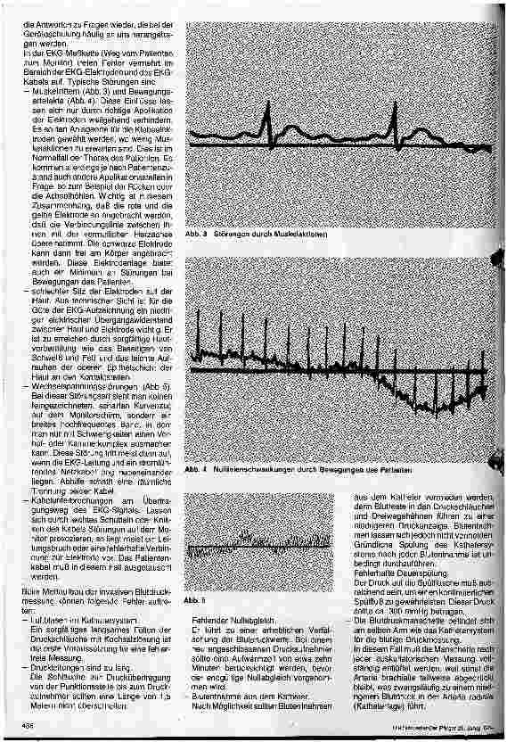 Vorschauseite 2: Grundund Behandlungspflege in der Intensivmedizin 8. Folge Schluß Krankenpflegepersonal und Technik