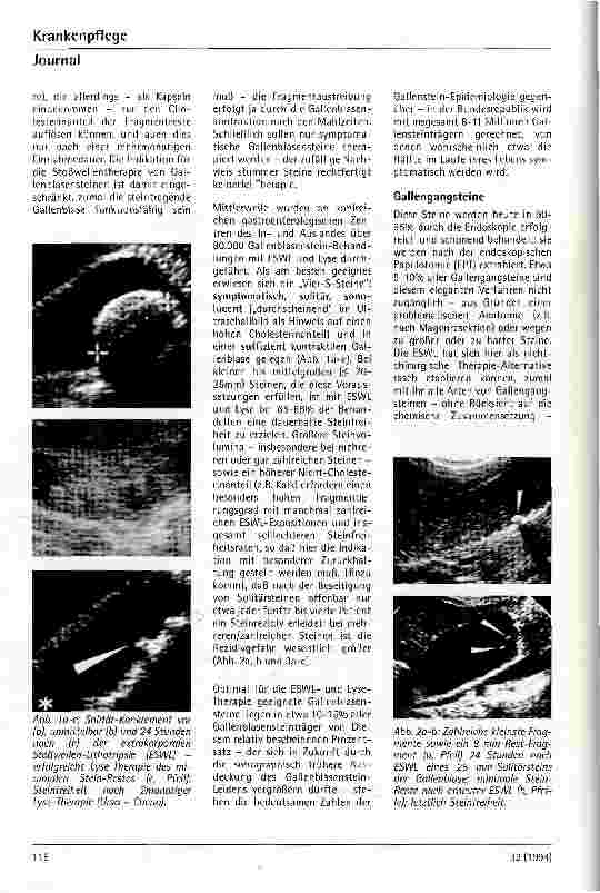 Vorschauseite 2: Extrakorporale Stoßwellenlithotripsie in der Gastroenterologie (ESWL) Fortschritte in der Therapie von Gallenund Pankreassteinen