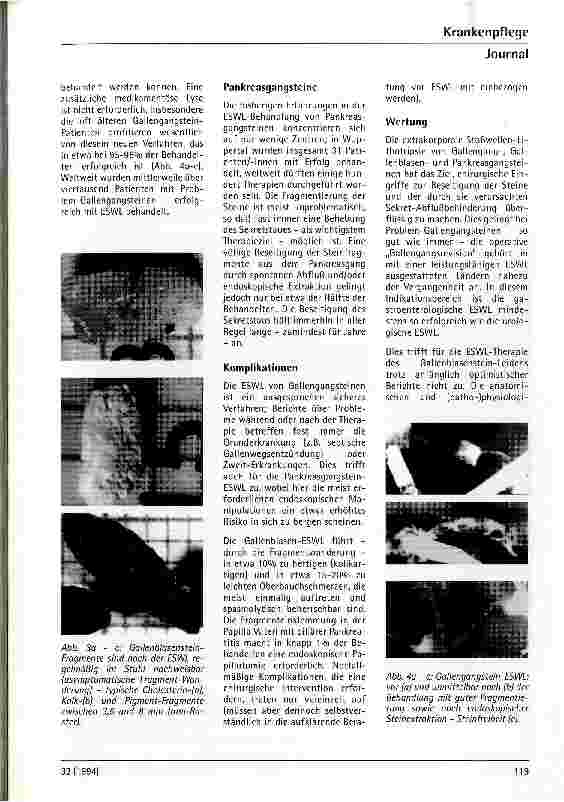 Vorschauseite 3: Extrakorporale Stoßwellenlithotripsie in der Gastroenterologie (ESWL) Fortschritte in der Therapie von Gallenund Pankreassteinen