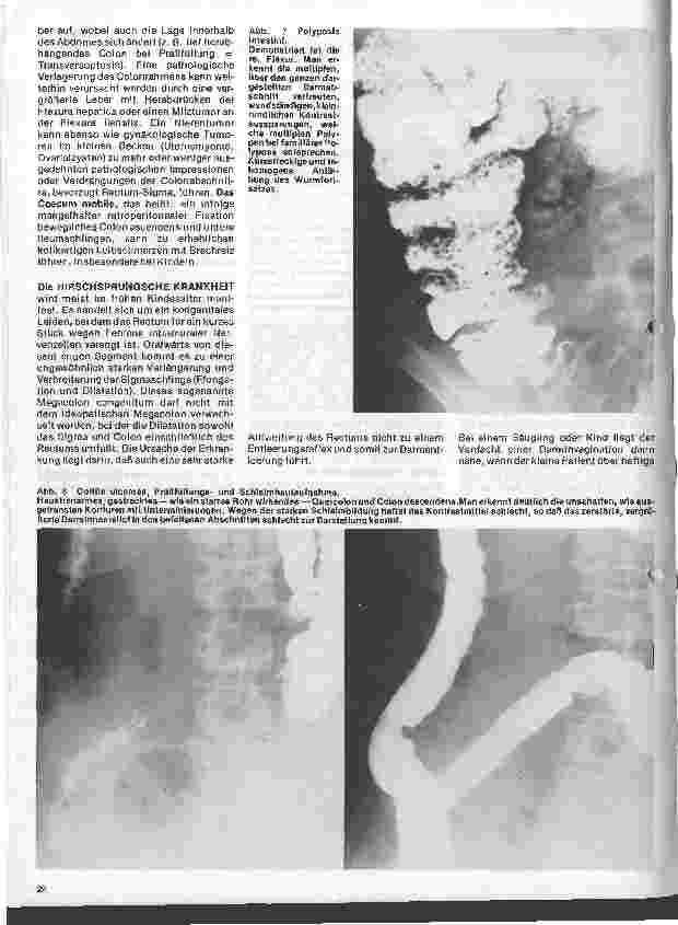 Vorschauseite 2: Radiologie Eine Einführung für Krankenschwestern u. Krankenpfleger 19. Folge: Röntgenuntersuchungen des Magen-Darm-Traktes