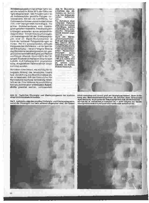Vorschauseite 4: Radiologie Eine Einführung für Krankenschwestern u. Krankenpfleger 19. Folge: Röntgenuntersuchungen des Magen-Darm-Traktes