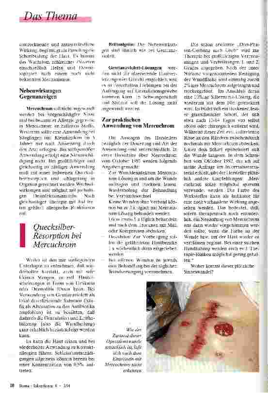 Vorschauseite 2: Munter drauflos gepinselt Farbstoffe in der Stomatherapie und Wundversorgung - Sinn oder Unsinn?