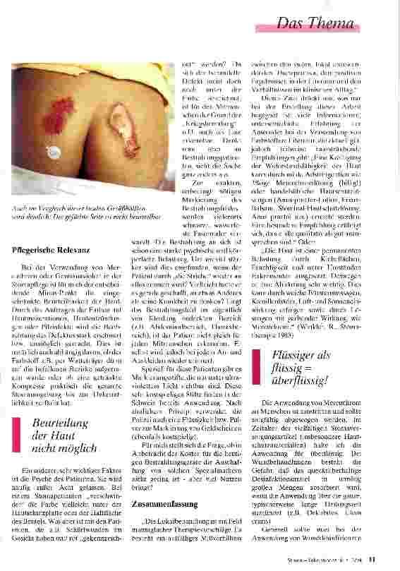Vorschauseite 3: Munter drauflos gepinselt Farbstoffe in der Stomatherapie und Wundversorgung - Sinn oder Unsinn?