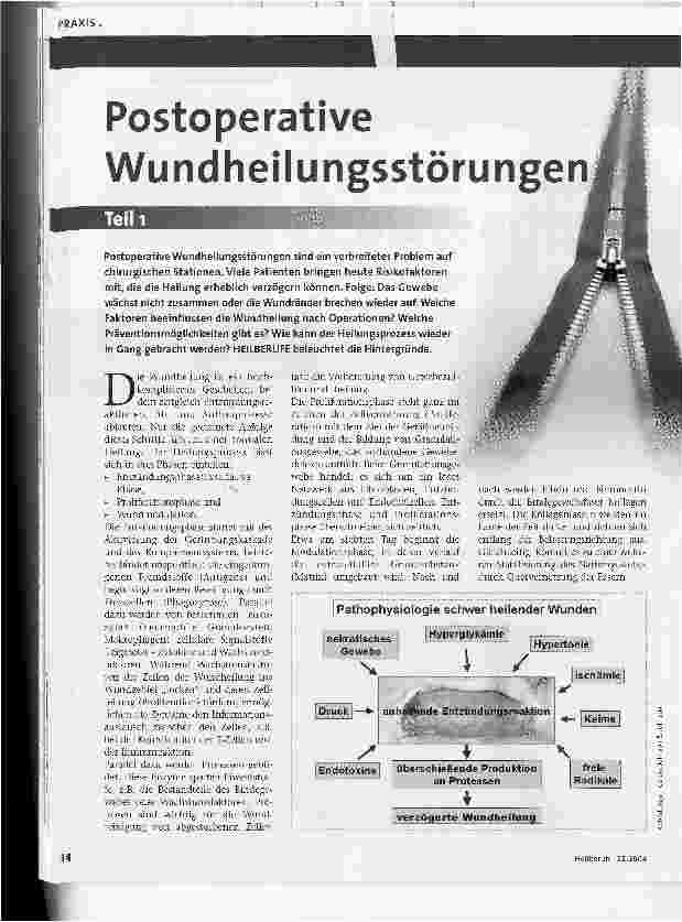 Vorschauseite 1: Postoperative Wundheiiungsstörungen Teil 1