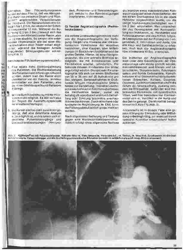 Vorschauseite 2: Radiologie 22. Folge: Die radiologische Untersuchung des Herzens