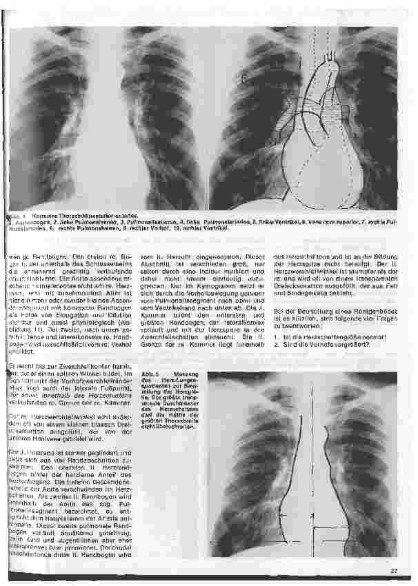 Vorschauseite 4: Radiologie 22. Folge: Die radiologische Untersuchung des Herzens
