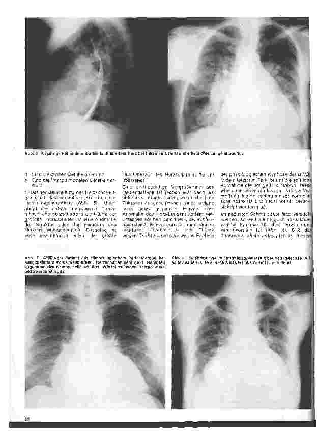 Vorschauseite 5: Radiologie 22. Folge: Die radiologische Untersuchung des Herzens
