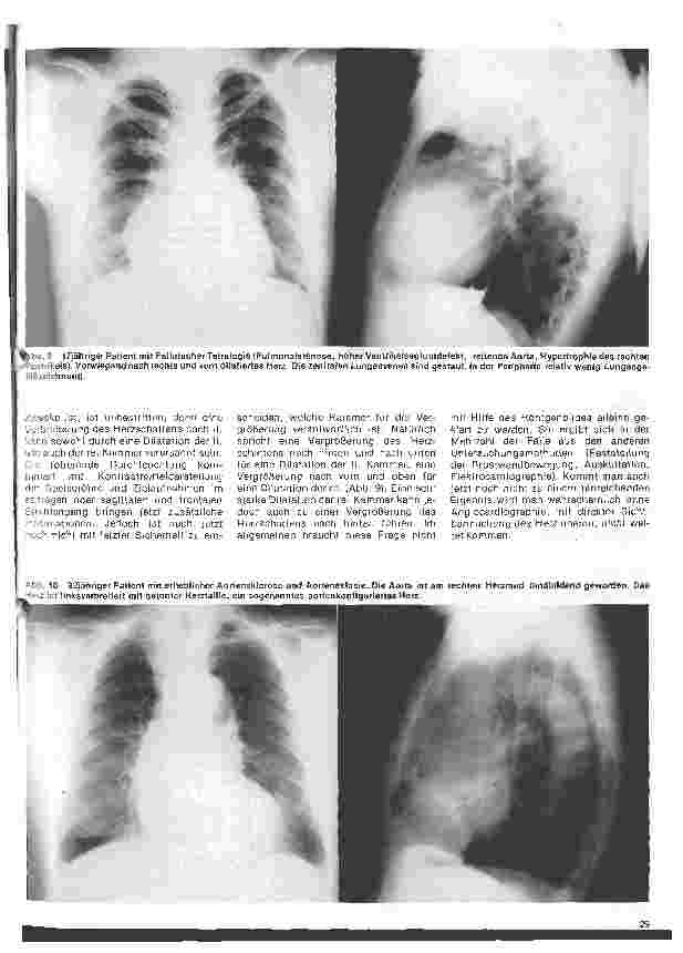 Vorschauseite 6: Radiologie 22. Folge: Die radiologische Untersuchung des Herzens