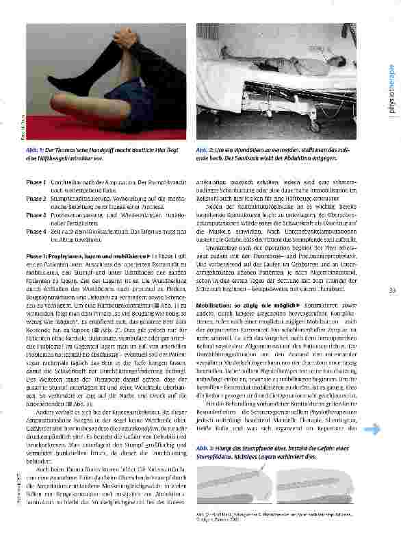 Vorschauseite 2: Postoperative Physiotherapie nach Beinamputation Auf die Prothese vorbereiten