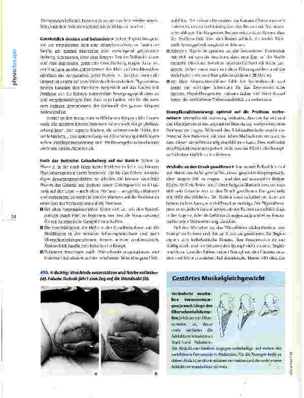 Vorschauseite 3: Postoperative Physiotherapie nach Beinamputation Auf die Prothese vorbereiten