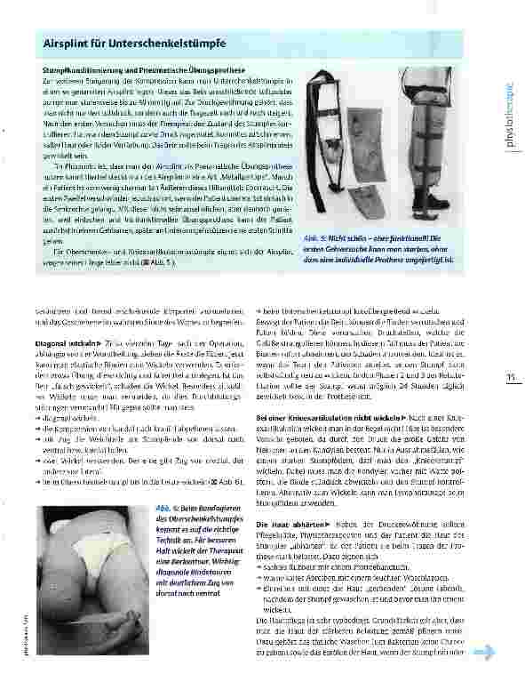 Vorschauseite 4: Postoperative Physiotherapie nach Beinamputation Auf die Prothese vorbereiten