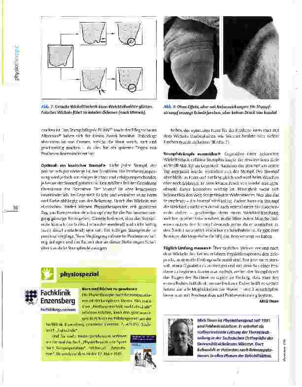 Vorschauseite 5: Postoperative Physiotherapie nach Beinamputation Auf die Prothese vorbereiten