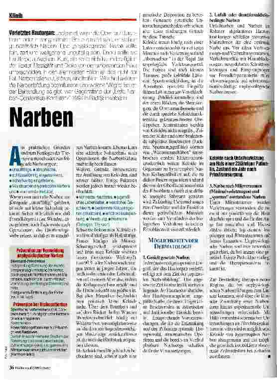 Vorschauseite 1: Narben Verletztes Hautorgan