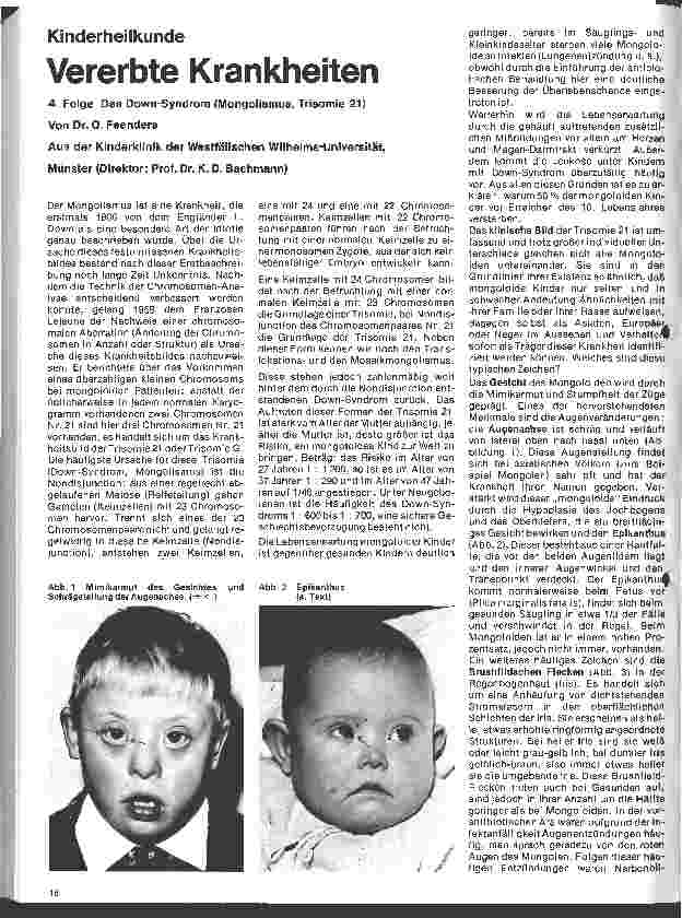 Vorschauseite 1: Kinderheilkunde Vererbte Krankheiten 4. Folge: Das Down-Syndrom (Mongolismus, Trisomie 21)