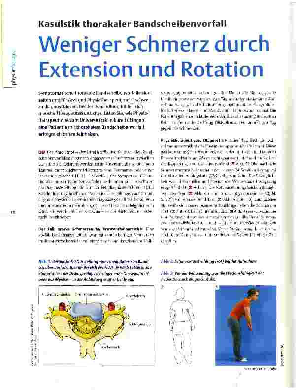 Vorschauseite 1: Kasuistik thorakaler Bandscheibenvorfall Weniger Schmerz durch Extension und Rotation