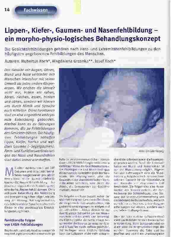 Vorschauseite 1: Lippen-, Kiefer-, Gaumenund Nasenfehlbildung -ein morpho-physio-logisches Behandlungskonzept