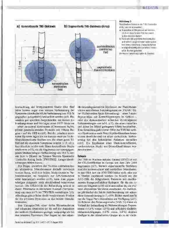 Vorschauseite 5: Tiefe Hirnstimulation bei neurologischen und psychiatrischen Erkrankungen