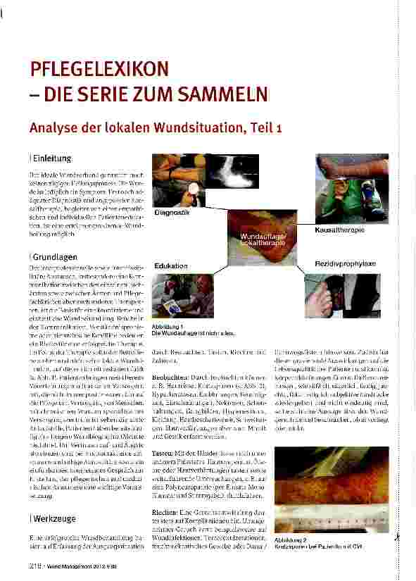 Vorschauseite 1: PFLEGELEXIKON -DIE SERIE ZUM SAMMELN Analyse der lokalen Wundsituation, Teil 1