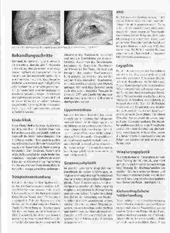 Vorschauseite 2: Teamwork - Interdisziplinäre Zusammenarbeit am Beispiel der LKG-Rehabilitation an der Uniklinik Mainz