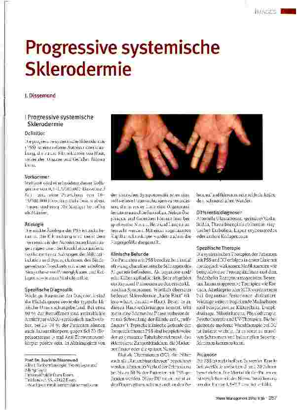 Vorschauseite 1: Progressive systemische Sklerodermie