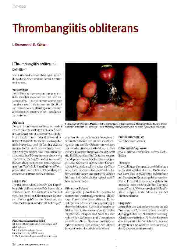 Vorschauseite 1: Thrombangiitis obliterans