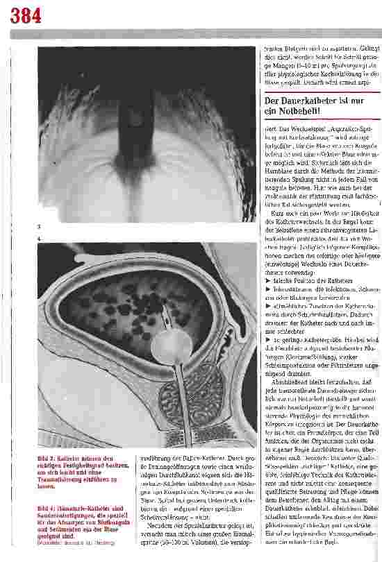 Vorschauseite 3: Komplikationsprophylaxe bei Dauerkathetern