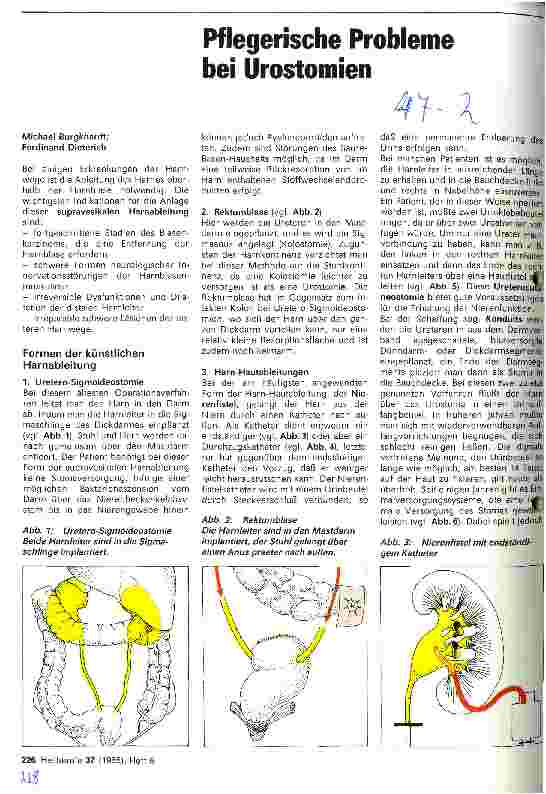 Vorschauseite 1: Pflegerische Probleme bei Urostomien