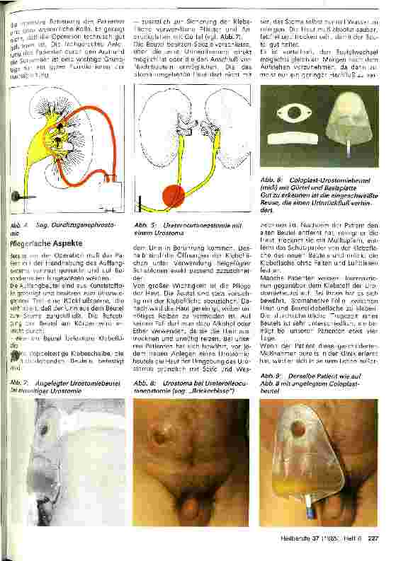 Vorschauseite 2: Pflegerische Probleme bei Urostomien
