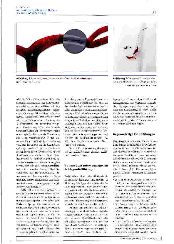 Vorschauseite 4: Interventionelle Schlaganfalltherapie