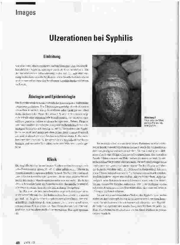 Vorschauseite 1: Ulzerationen bei Syphilis