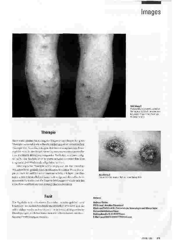 Vorschauseite 2: Ulzerationen bei Syphilis