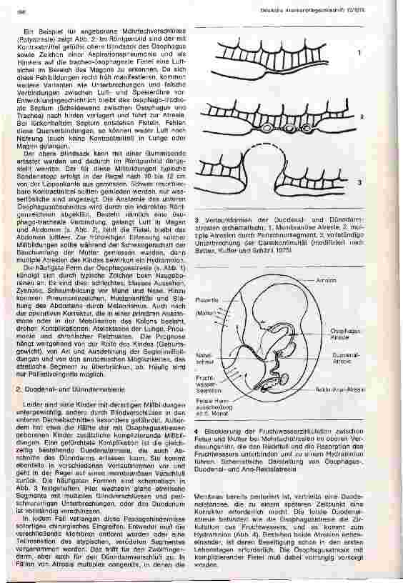 Vorschauseite 2: Das Syndrom der multiplen Blindverschlüsse