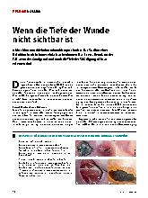 Vorschauseite 1: Wenn die Tiefe der Wunde nicht sichtbar ist.