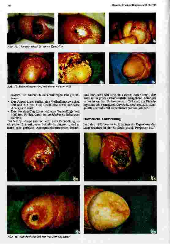 Vorschauseite 3: Möglichkeiten der Lasertherapie in der Urologie