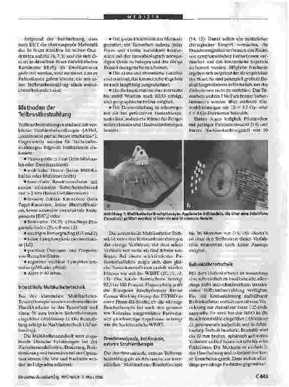 Vorschauseite 2: Brustkrebs: Teilbrustbestrahlung nach brusterhaltender Operation