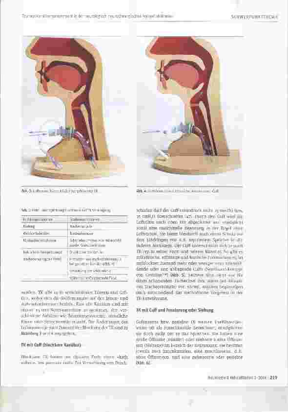 Vorschauseite 3: Trachealkanülenmanagement in der neurologisch-neurochlrurgischen Frührehabilitation