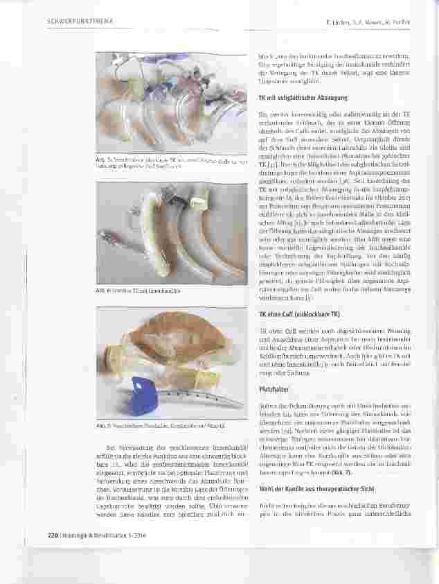 Vorschauseite 4: Trachealkanülenmanagement in der neurologisch-neurochlrurgischen Frührehabilitation